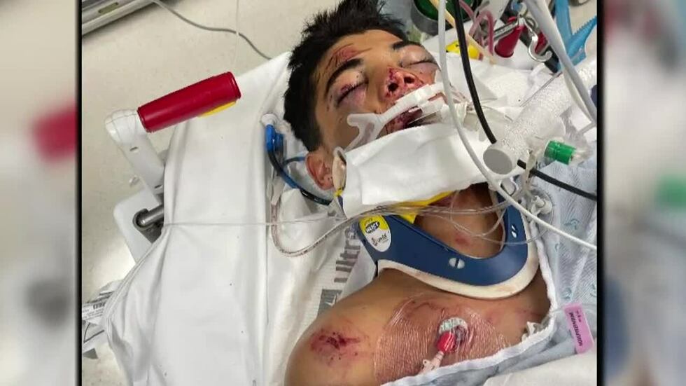 The family of a 14-year-old boy paralyzed in a car crash in Makaha nine days ago has sued the...