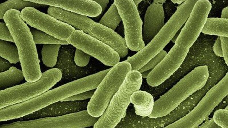 DOH officials found a new case of Legionnaire's disease last week.(Image: Pixabay)