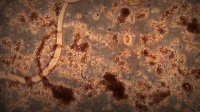 Rat lungworm disease has sickened two more people on the Big Island. (Image: Hawaii News Now)